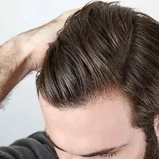 التماس دعا برای رویش مو